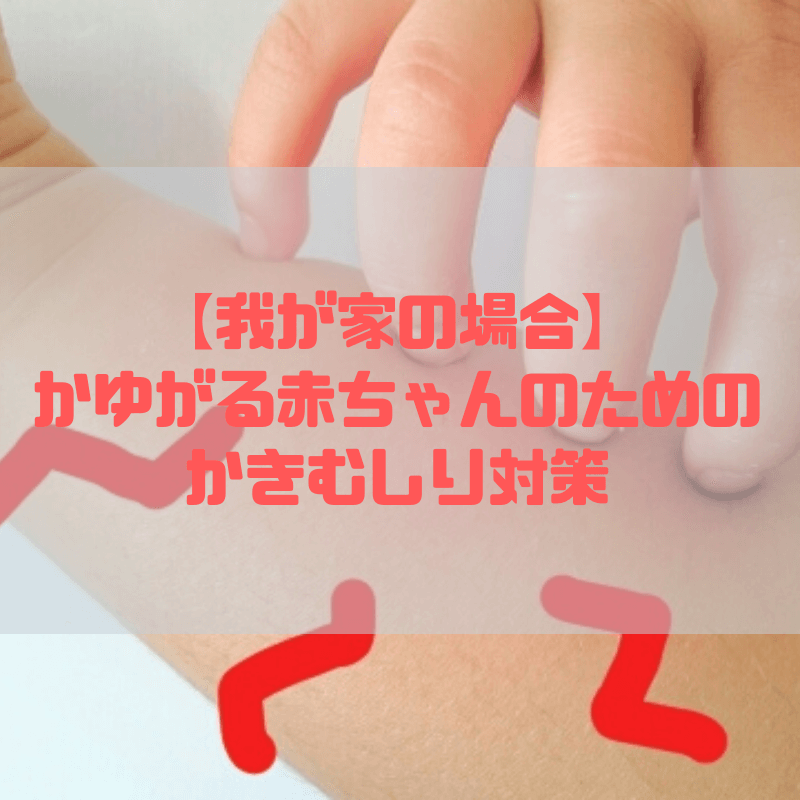 我が家の場合 かゆがる赤ちゃんのためのかきむしり対策 京都で理系的こそだて